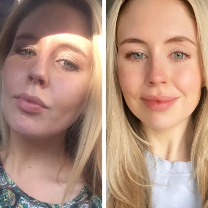 Microneedling before after pen dr a6 skincare update